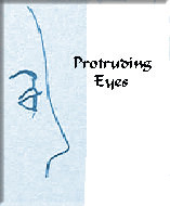 protruding eyes, think 'Susan Sarandon'